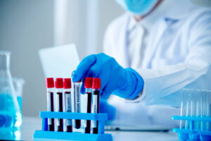 Stool Test